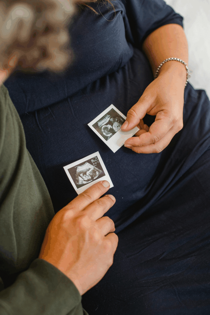 Pregnant woman and her husband holding an ultrasound photo during their twin pregnancy journey